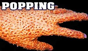 Image result for Trypophobia On Hand