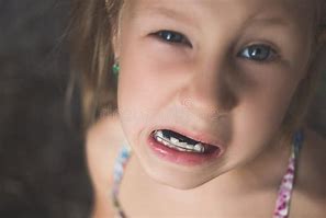 Image result for Little Girl Crooked Teeth