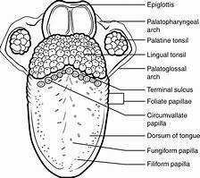 Image result for Wart On Side of Tongue