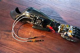 Image result for Amupated Arm Robot