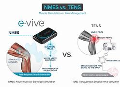 Image result for Electrical Stimulation vs Tens Unit