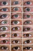 Image result for Rarest Eye Color Chart