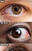Image result for Dark Brown Eye Color