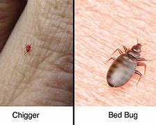 Image result for Chigger vs Mosquito Bites