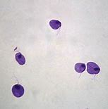 Image result for Trichomonas Under Microscope