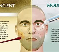 Image result for Ancient vs Modern Medicine