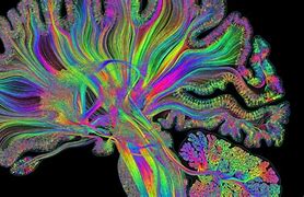 Image result for Human Brain Inspiration
