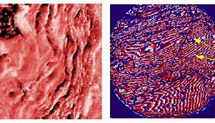 Image result for Acoustic Microscopy