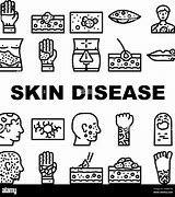 Image result for Weird Skin Diseases