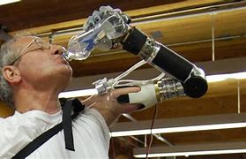 Image result for First Prosthetic Arm