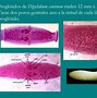 Bildergebnis für diphyllobothriosis