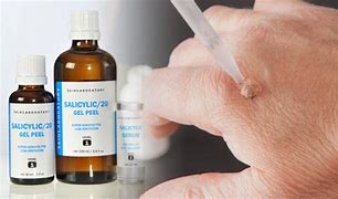Image result for Topical Treatment for Warts