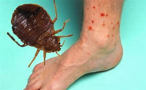 Image result for What Does Bed Bug Bites Look Like