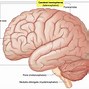 Image result for Brain Temporal Lobe