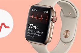 Image result for Abnormal ECG On Apple Watch