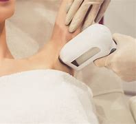 Image result for Laser Hair Removal Near Me