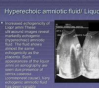 Image result for Echogenic Amniotic Fluid Ultrasound