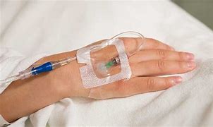 Image result for Cannula in Hand