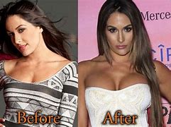 Image result for Nikki Bella Before Plastic Surgery