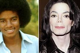 Image result for MJ Before and After