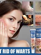 Image result for Home Wart Treatments