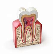Image result for dentina