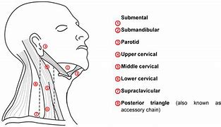 Image result for Schematic Diagram of Head and Neck Cancer