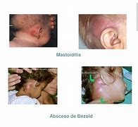 Image result for ansceso