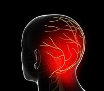 Image result for Arnold Neuralgia