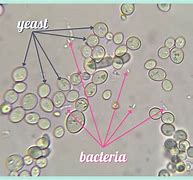 Image result for Yeast Cell Size