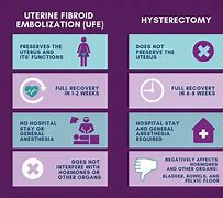 Image result for Hysterectomy Fibroid Tumors Uterine