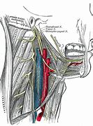 Image result for Carotid Body and Sinus
