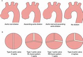 Image result for 1 Cm Dilated