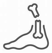 Image result for Broken Foot Clip Art