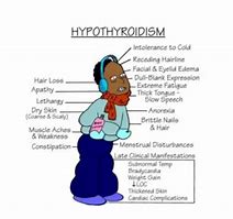 Image result for Hypothyroidism Memes
