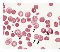 Image result for Homozygous Cells