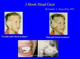 Image result for Folding J-Hook