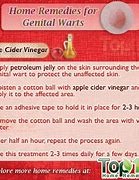 Image result for 777 Male Genital Warts