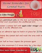 Image result for Red Genital Warts
