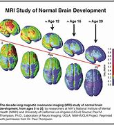 Image result for Adult Brain Development