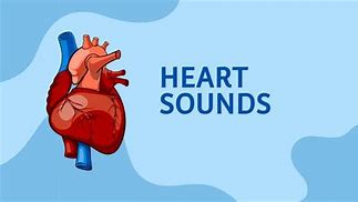 Image result for S3 Heart Sound
