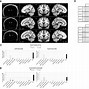 Image result for CT mm Chart