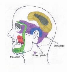 Head Neck And Shoulder Trigger Point Chart 3 169 Copyright