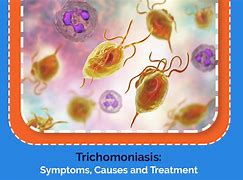 Image result for Trichomoniasis Symptoms