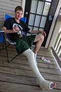 Image result for Broken Leg Ambulance
