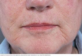 Image result for Wrinkles