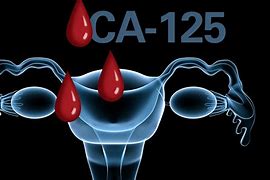 Image result for ca 125