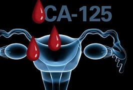Image result for ca125