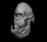 Image result for Cyclopia