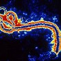 Image result for albu�ebola